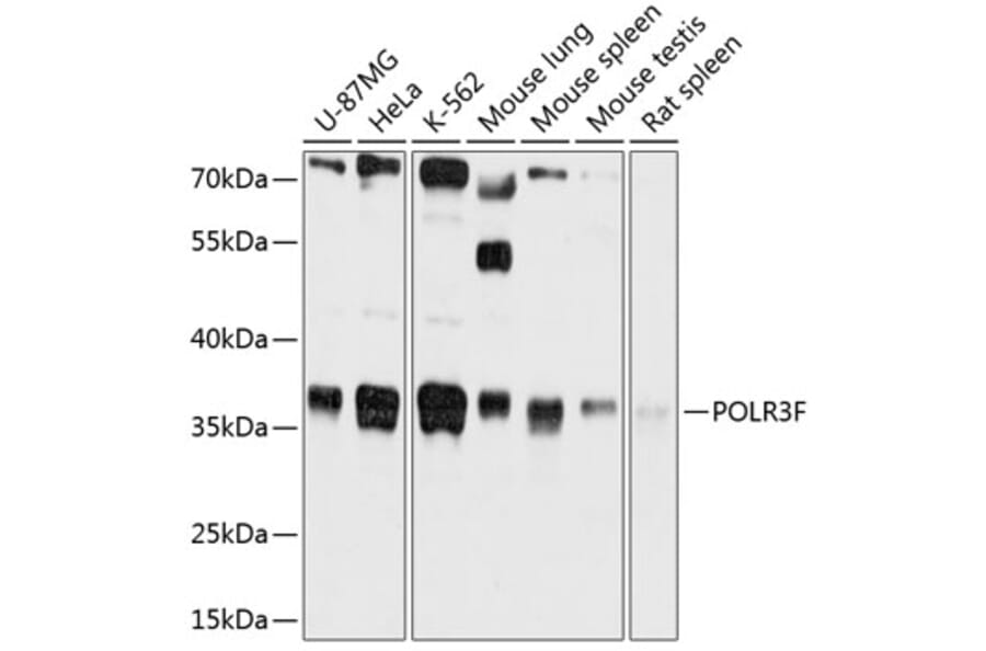 Western Blot - Anti-RPC39 Antibody (A80755) - Antibodies.com