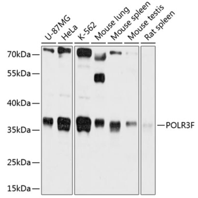 Western Blot - Anti-RPC39 Antibody (A80755) - Antibodies.com