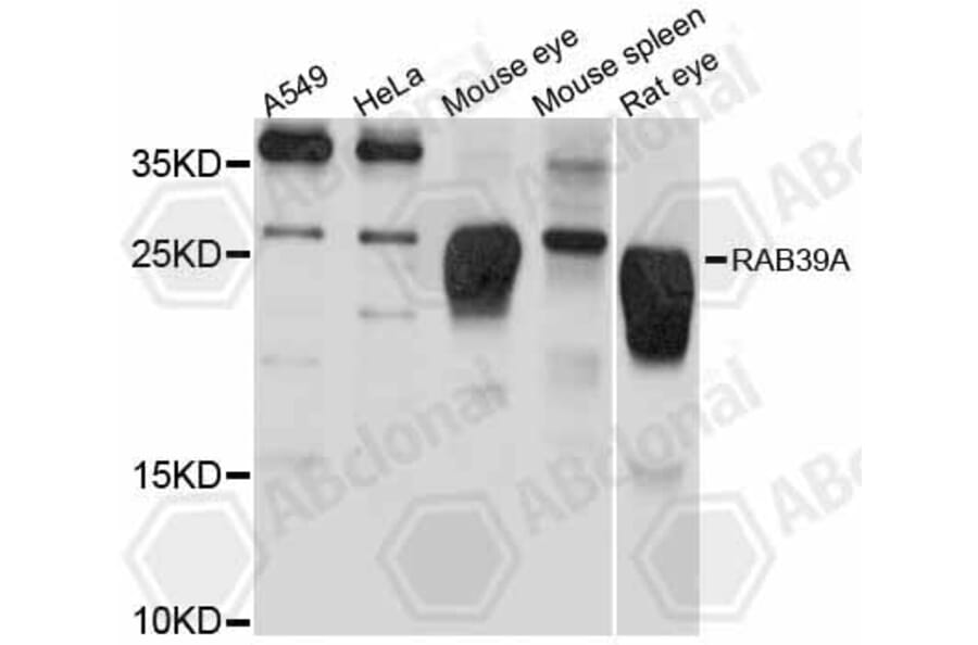 Western Blot - Anti-RAB39A Antibody (A12225) - Antibodies.com