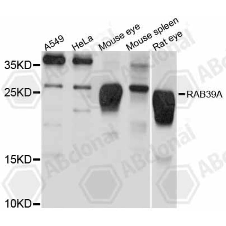 Western Blot - Anti-RAB39A Antibody (A12225) - Antibodies.com