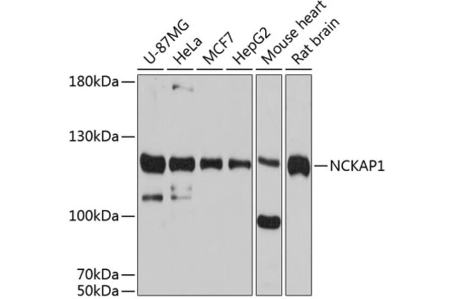 Western Blot - Anti-NCKAP1 Antibody (A80757) - Antibodies.com