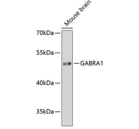 Western Blot - Anti-GABA A Receptor alpha 1 Antibody (A80758) - Antibodies.com