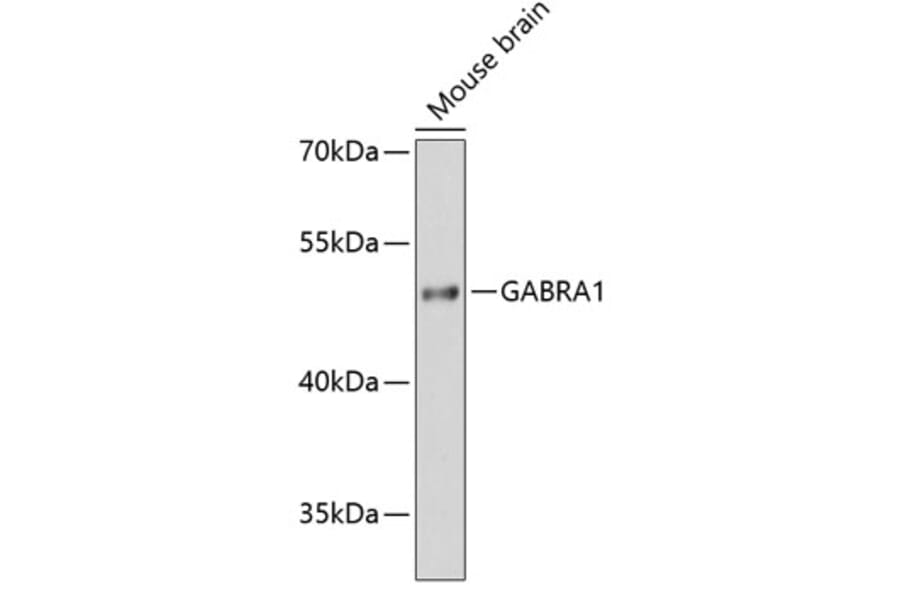 Western Blot - Anti-GABA A Receptor alpha 1 Antibody (A80758) - Antibodies.com