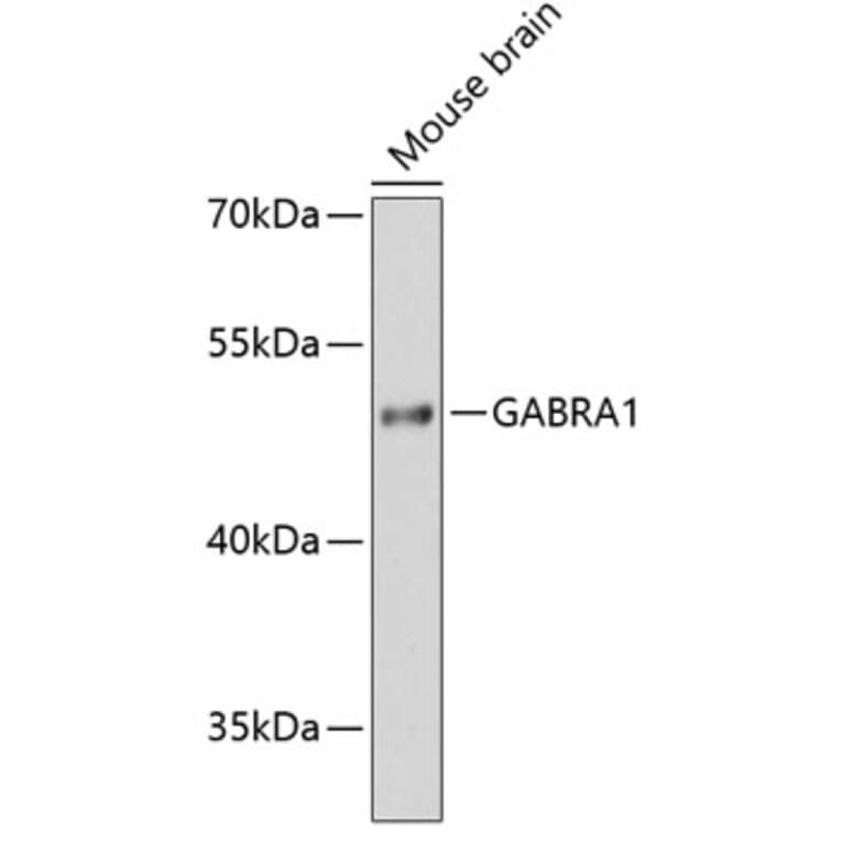 Western Blot - Anti-GABA A Receptor alpha 1 Antibody (A80758) - Antibodies.com