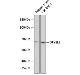 Western Blot - Anti-CRMP4 Antibody (A80759) - Antibodies.com