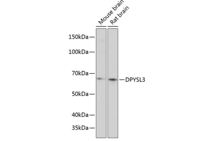 Western Blot - Anti-CRMP4 Antibody (A80759) - Antibodies.com