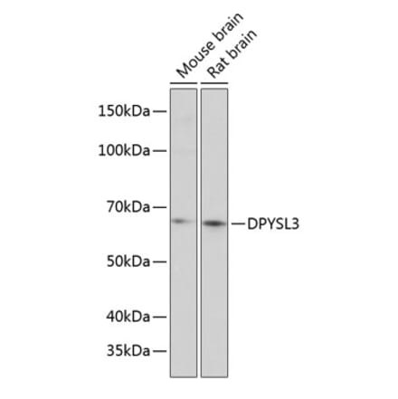 Western Blot - Anti-CRMP4 Antibody (A80759) - Antibodies.com