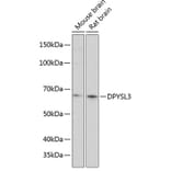 Western Blot - Anti-CRMP4 Antibody (A80759) - Antibodies.com