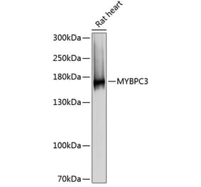 Western Blot - Anti-MYBPC3 Antibody (A80760) - Antibodies.com