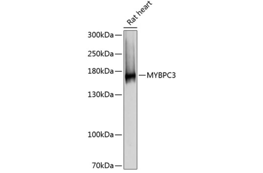 Western Blot - Anti-MYBPC3 Antibody (A80760) - Antibodies.com