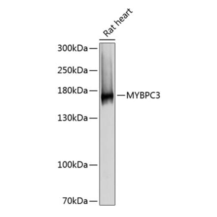 Western Blot - Anti-MYBPC3 Antibody (A80760) - Antibodies.com