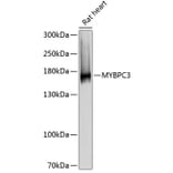 Western Blot - Anti-MYBPC3 Antibody (A80760) - Antibodies.com