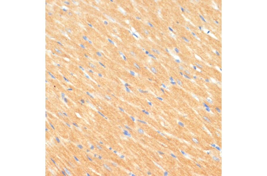 Immunohistochemistry - Anti-MYBPC3 Antibody (A80760) - Antibodies.com