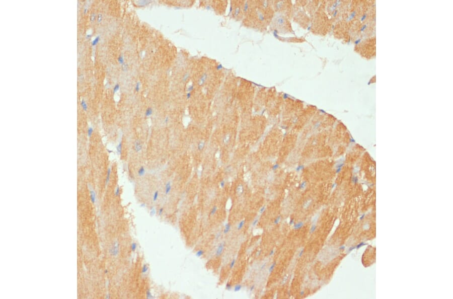 Immunohistochemistry - Anti-MYBPC3 Antibody (A80760) - Antibodies.com