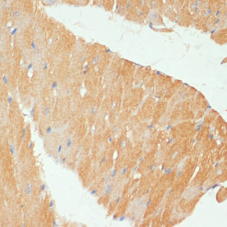 Immunohistochemistry - Anti-MYBPC3 Antibody (A80760) - Antibodies.com