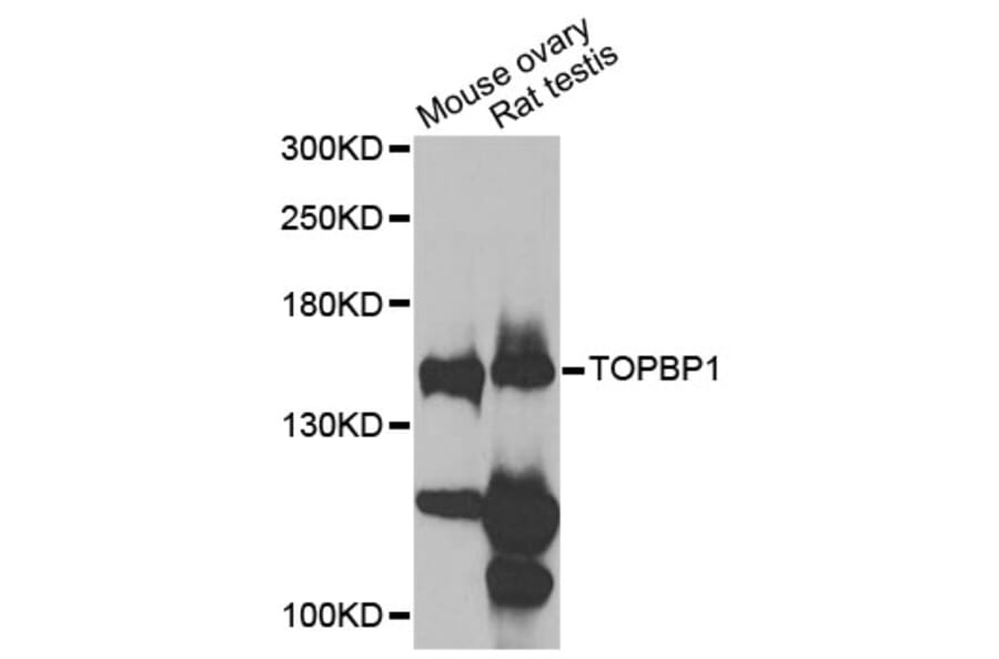 Western Blot - Anti-TOPBP1 Antibody (A12566) - Antibodies.com