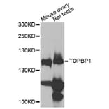 Western Blot - Anti-TOPBP1 Antibody (A12566) - Antibodies.com