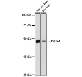 Western Blot - Anti-UGT1A1 Antibody (A80764) - Antibodies.com