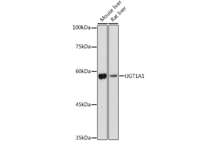 Western Blot - Anti-UGT1A1 Antibody (A80764) - Antibodies.com