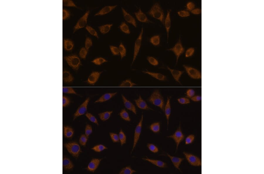 Immunofluorescence - Anti-UGT1A1 Antibody (A80764) - Antibodies.com