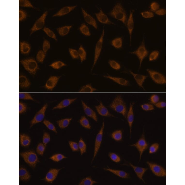 Immunofluorescence - Anti-UGT1A1 Antibody (A80764) - Antibodies.com