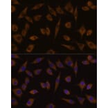 Immunofluorescence - Anti-UGT1A1 Antibody (A80764) - Antibodies.com