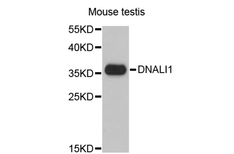 Western Blot - Anti-DNALI1 Antibody (A4190) - Antibodies.com