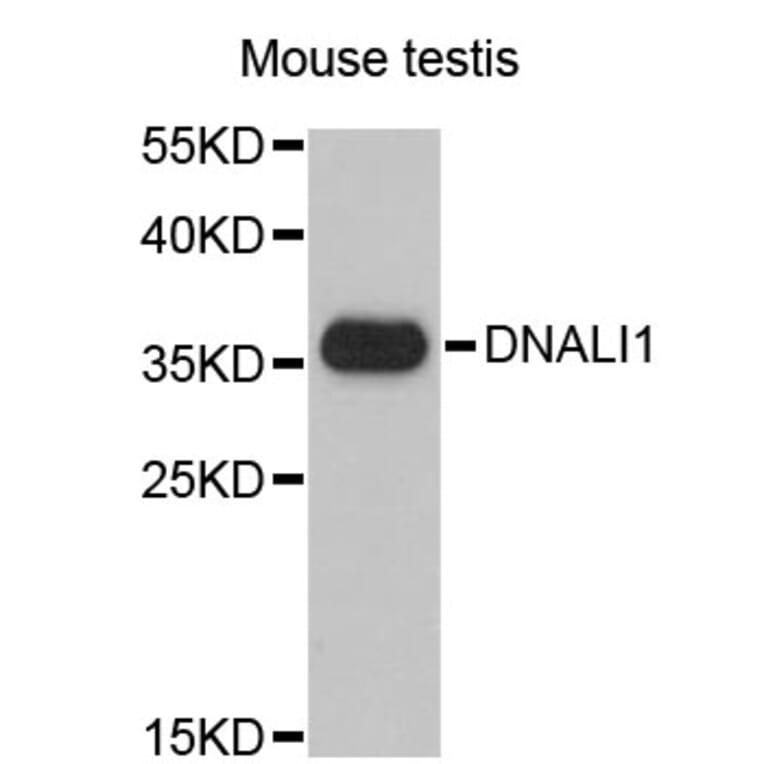 Western Blot - Anti-DNALI1 Antibody (A4190) - Antibodies.com