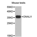 Western Blot - Anti-DNALI1 Antibody (A4190) - Antibodies.com