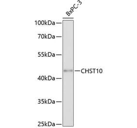 Western Blot - Anti-HNK-1ST Antibody (A80766) - Antibodies.com