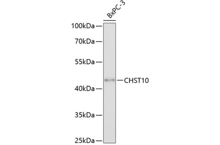 Western Blot - Anti-HNK-1ST Antibody (A80766) - Antibodies.com
