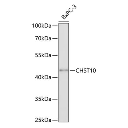 Western Blot - Anti-HNK-1ST Antibody (A80766) - Antibodies.com