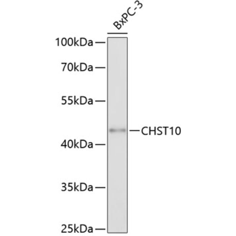 Western Blot - Anti-HNK-1ST Antibody (A80766) - Antibodies.com