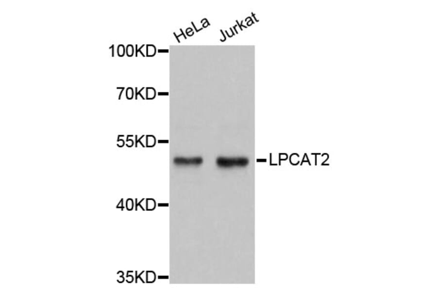 Western Blot - Anti-LPCAT2 Antibody (A4805) - Antibodies.com