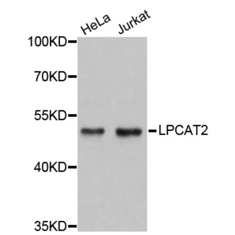 Western Blot - Anti-LPCAT2 Antibody (A4805) - Antibodies.com