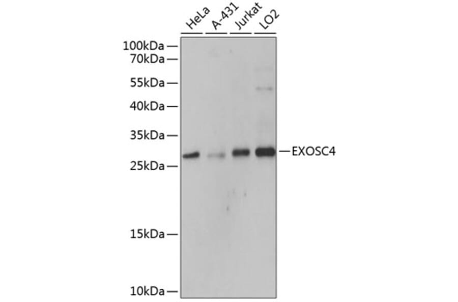 Western Blot - Anti-RRP41 Antibody (A80768) - Antibodies.com