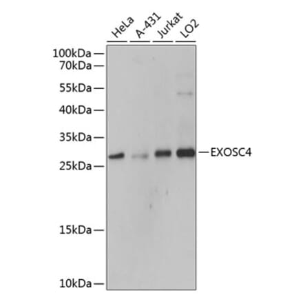 Western Blot - Anti-RRP41 Antibody (A80768) - Antibodies.com