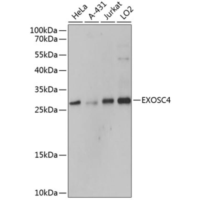 Western Blot - Anti-RRP41 Antibody (A80768) - Antibodies.com