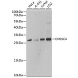 Western Blot - Anti-RRP41 Antibody (A80768) - Antibodies.com