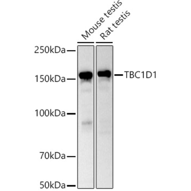 Western Blot - Anti-TBC1D1 Antibody (A80769) - Antibodies.com