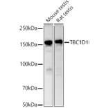 Western Blot - Anti-TBC1D1 Antibody (A80769) - Antibodies.com