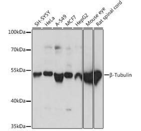Western Blot - Anti-beta Tubulin Antibody (A80770) - Antibodies.com