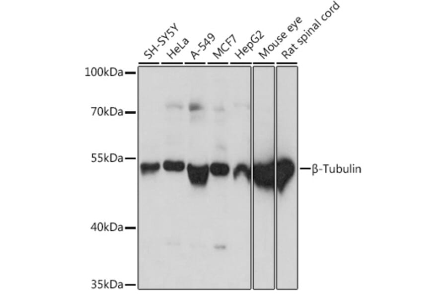 Western Blot - Anti-beta Tubulin Antibody (A80770) - Antibodies.com
