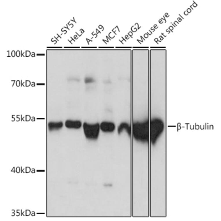 Western Blot - Anti-beta Tubulin Antibody (A80770) - Antibodies.com