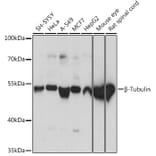 Western Blot - Anti-beta Tubulin Antibody (A80770) - Antibodies.com