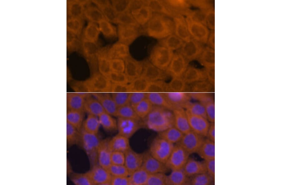 Immunofluorescence - Anti-beta Tubulin Antibody (A80770) - Antibodies.com