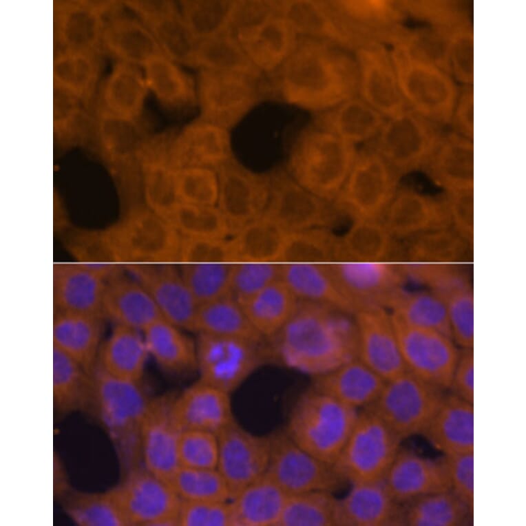 Immunofluorescence - Anti-beta Tubulin Antibody (A80770) - Antibodies.com
