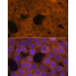 Immunofluorescence - Anti-beta Tubulin Antibody (A80770) - Antibodies.com