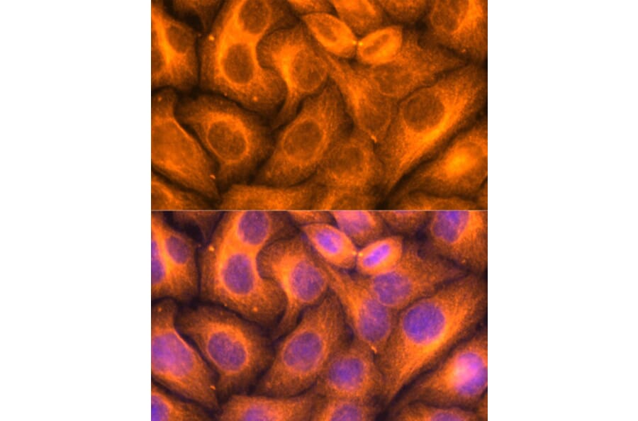 Immunofluorescence - Anti-beta Tubulin Antibody (A80770) - Antibodies.com