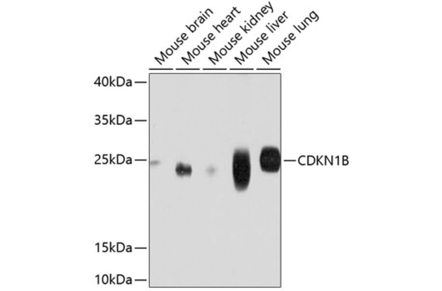 Western Blot - Anti-CDKN1B Antibody (A11800) - Antibodies.com